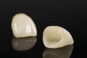 Dental Crowns ready for a patient