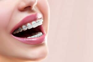 Orthodontics - Dental Services