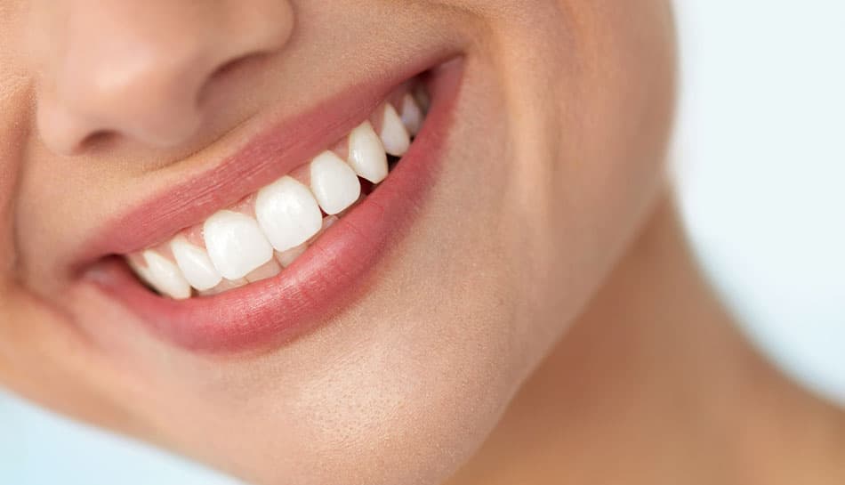 Closeup of a female's white smile